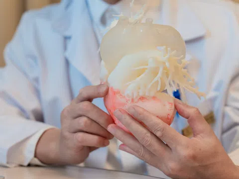 Vinmec chinh phục ca TAVI phức tạp nhờ công nghệ in 3D cá thể hóa: Bước tiến mới của tim mạch can thiệp